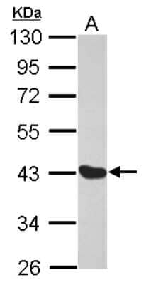 Western Blot: MAGEA1 Antibody [NBP2-17202]