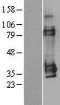 Western Blot: MAGEA1 Overexpression Lysate [NBL1-12797]