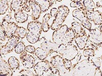 Immunohistochemistry-Paraffin: MAGEA10 Antibody [NBP3-06272]