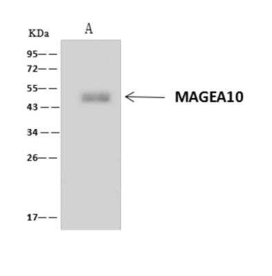 Immunoprecipitation: MAGEA10 Antibody [NBP3-06272]