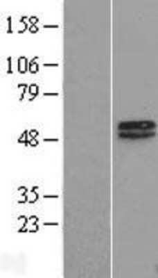 Western Blot: MAGEA10 Overexpression Lysate [NBP2-06570]