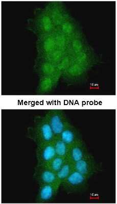Immunocytochemistry/ Immunofluorescence: MAGEA11 Antibody [NBP1-31210]
