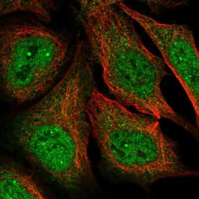 Immunocytochemistry/ Immunofluorescence: MAGEA11 Antibody [NBP2-55827]