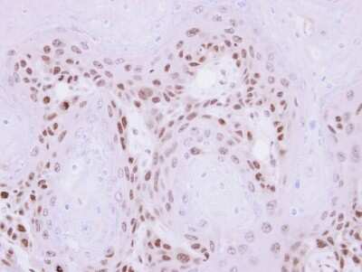 Immunohistochemistry-Paraffin: MAGEA11 Antibody [NBP1-31210]