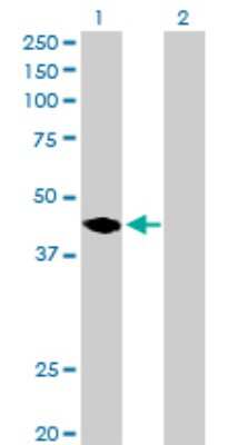 Western Blot: MAGEA11 Antibody [H00004110-D01P]