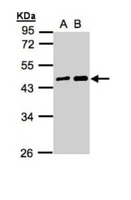 Western Blot: MAGEA11 Antibody [NBP1-31210]