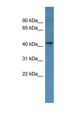 Western Blot: MAGEA11 Antibody [NBP1-69034]