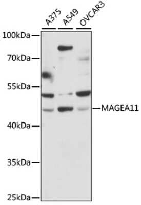 Western Blot: MAGEA11 AntibodyAzide and BSA Free [NBP3-04410]