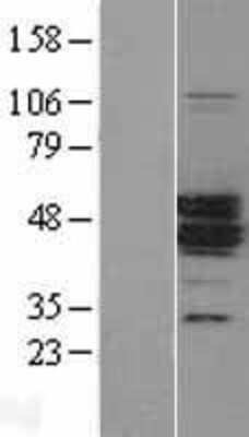 Western Blot: MAGEA11 Overexpression Lysate [NBL1-12799]