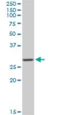 Western Blot: MAGEA12 Antibody (3A10) [H00004111-M01]