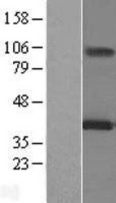 Western Blot: MAGEA12 Overexpression Lysate [NBL1-12800]