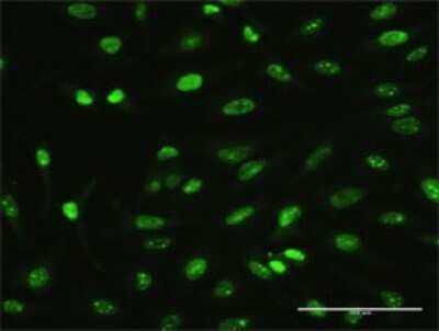 Immunocytochemistry/ Immunofluorescence: MAGEA2 Antibody (1B1) [H00004101-M02]