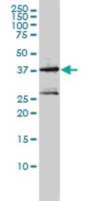 Western Blot: MAGEA2 Antibody (1H4) [H00004101-M01]