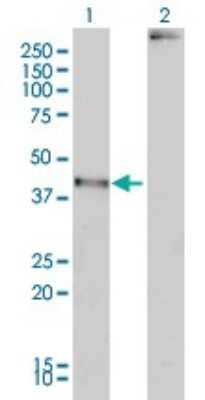 Western Blot: MAGEA2 Antibody (1H4) [H00004101-M01]