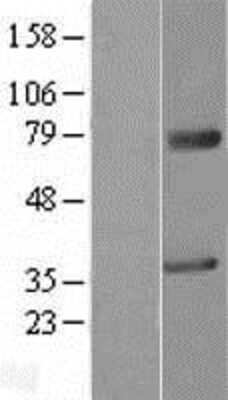 Western Blot: MAGEA2 Overexpression Lysate [NBL1-12801]