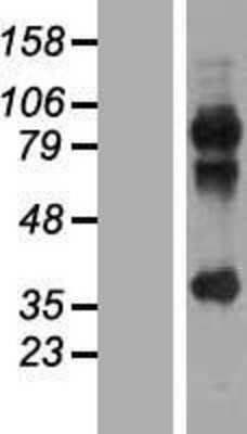 Western Blot: MAGEA2B Overexpression Lysate [NBL1-12802]