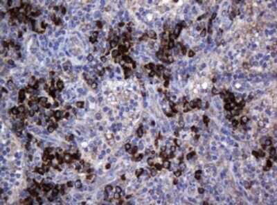 Immunohistochemistry: MAGEA3 Antibody (OTI1G9) [NBP2-45719]