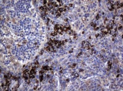 Immunohistochemistry: MAGEA3 Antibody (OTI1G9) [NBP2-45719]