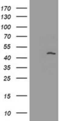 Western Blot: MAGEA3 Antibody (OTI1G9) [NBP2-45719]