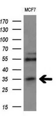 Western Blot: MAGEA3 Antibody (OTI1G9) [NBP2-45719]