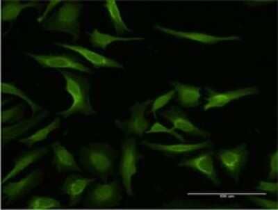 Immunocytochemistry/ Immunofluorescence: MAGEA3 Antibody (4D9) [H00004102-M02]