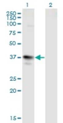 Western Blot: MAGEA3 Antibody (6D10) [H00004102-M01]