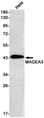 Western Blot: MAGEA3 Antibody (S07-8A2) [NBP3-19683]