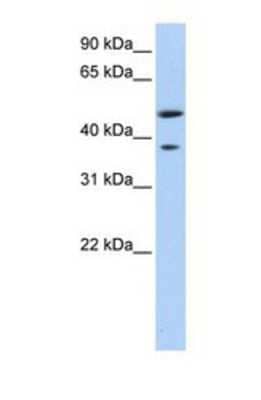 Western Blot: MAGEA3 Antibody [NBP1-56404]