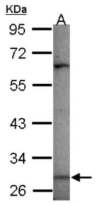 Western Blot: MAGEA3 Antibody [NBP2-17203]