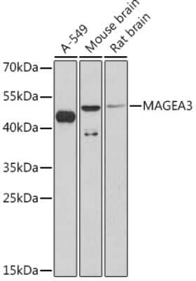 Western Blot: MAGEA3 AntibodyAzide and BSA Free [NBP3-15499]