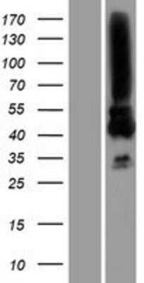 Western Blot: MAGEA3 Overexpression Lysate [NBP2-07759]