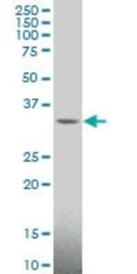 Western Blot: MAGEA4 Antibody (3D12) [H00004103-M01]