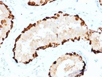 Immunohistochemistry-Paraffin: MAGEA4 Antibody (CPTC-MAGEA4-1) - Azide and BSA Free [NBP2-79861]