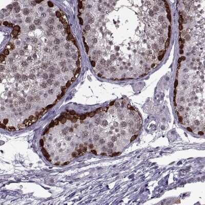 Immunohistochemistry-Paraffin: MAGEA4 Antibody [NBP1-84365]