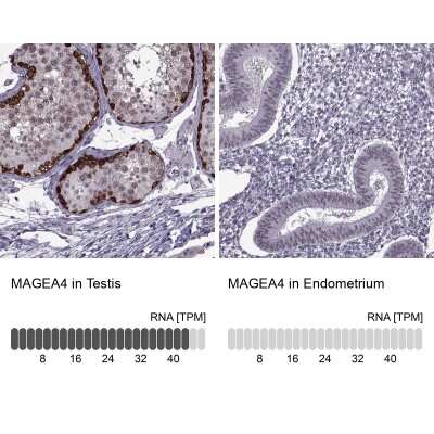 Immunohistochemistry-Paraffin: MAGEA4 Antibody [NBP1-84365]