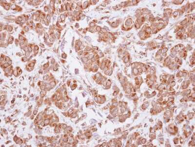Immunohistochemistry-Paraffin: MAGEA4 Antibody [NBP2-17204]