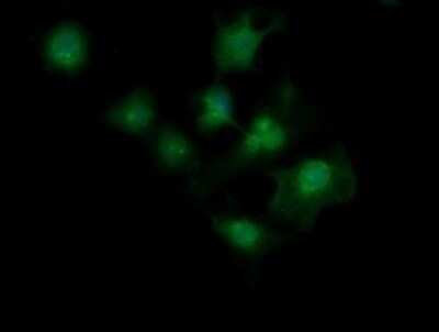 Immunocytochemistry/ Immunofluorescence: MAGEA4 Antibody (OTI2C1) - Azide and BSA Free [NBP2-72571]