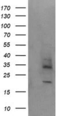 Western Blot: MAGEA4 Antibody (OTI2C1)Azide and BSA Free [NBP2-72571]