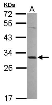 Western Blot: MAGEA4 Antibody [NBP2-17204]