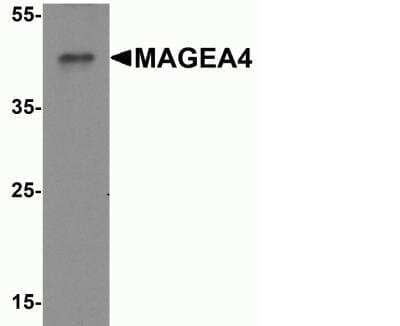 Western Blot: MAGEA4 AntibodyBSA Free [NBP2-41318]