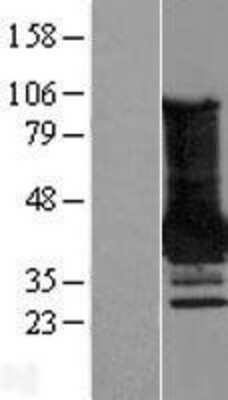 Western Blot: MAGEA4 Overexpression Lysate [NBL1-12803]