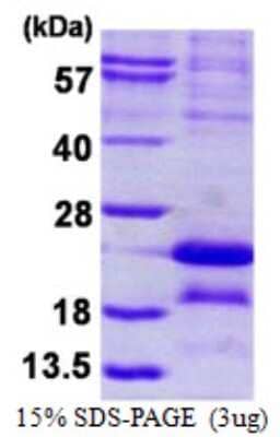 SDS-PAGE: Recombinant Human MAGEA5 His Protein [NBP2-23224]