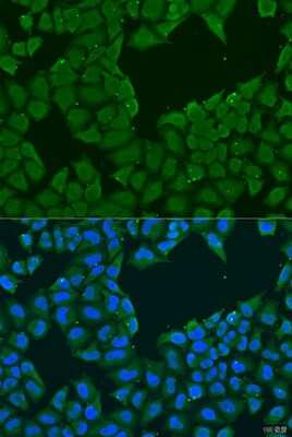 Immunocytochemistry/ Immunofluorescence: MAGEA6 Antibody - BSA Free [NBP3-05152]