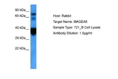 Western Blot: MAGEA6 Antibody [NBP2-84152]