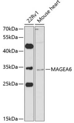 Western Blot: MAGEA6 AntibodyBSA Free [NBP3-05152]