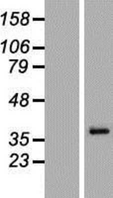 Western Blot: MAGEA6 Overexpression Lysate [NBL1-12804]