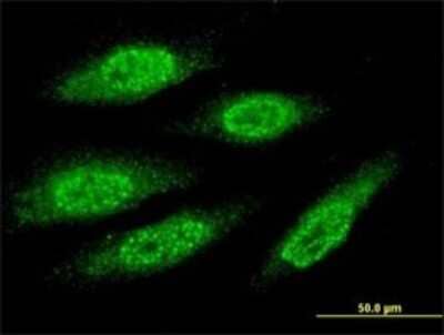 Immunocytochemistry/ Immunofluorescence: MAGEA8 Antibody (3F7) [H00004107-M01]