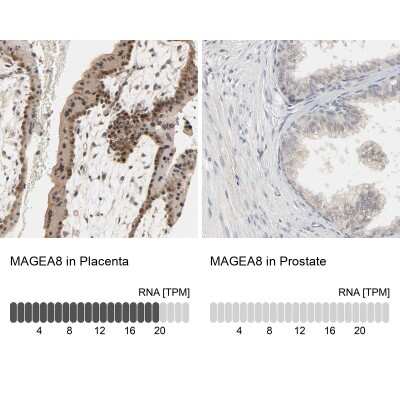 Immunohistochemistry-Paraffin: MAGEA8 Antibody [NBP1-92097]