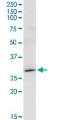 Western Blot: MAGEA8 Antibody [H00004107-D01P]