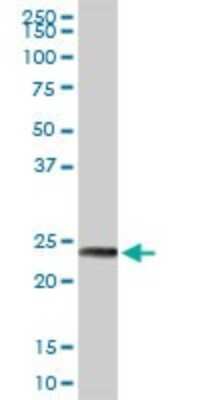 Western Blot: MAGEA8 Antibody [H00004107-D01P]